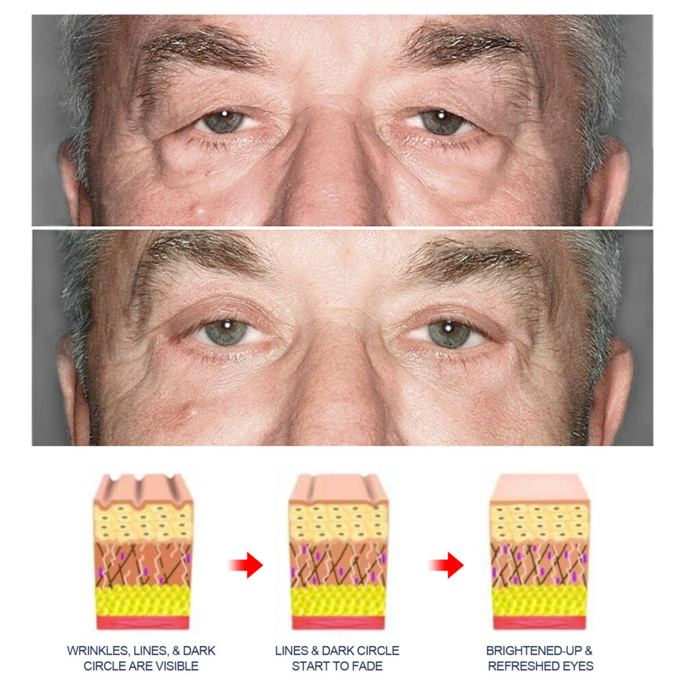 Peptide Eye gel - Image 5
