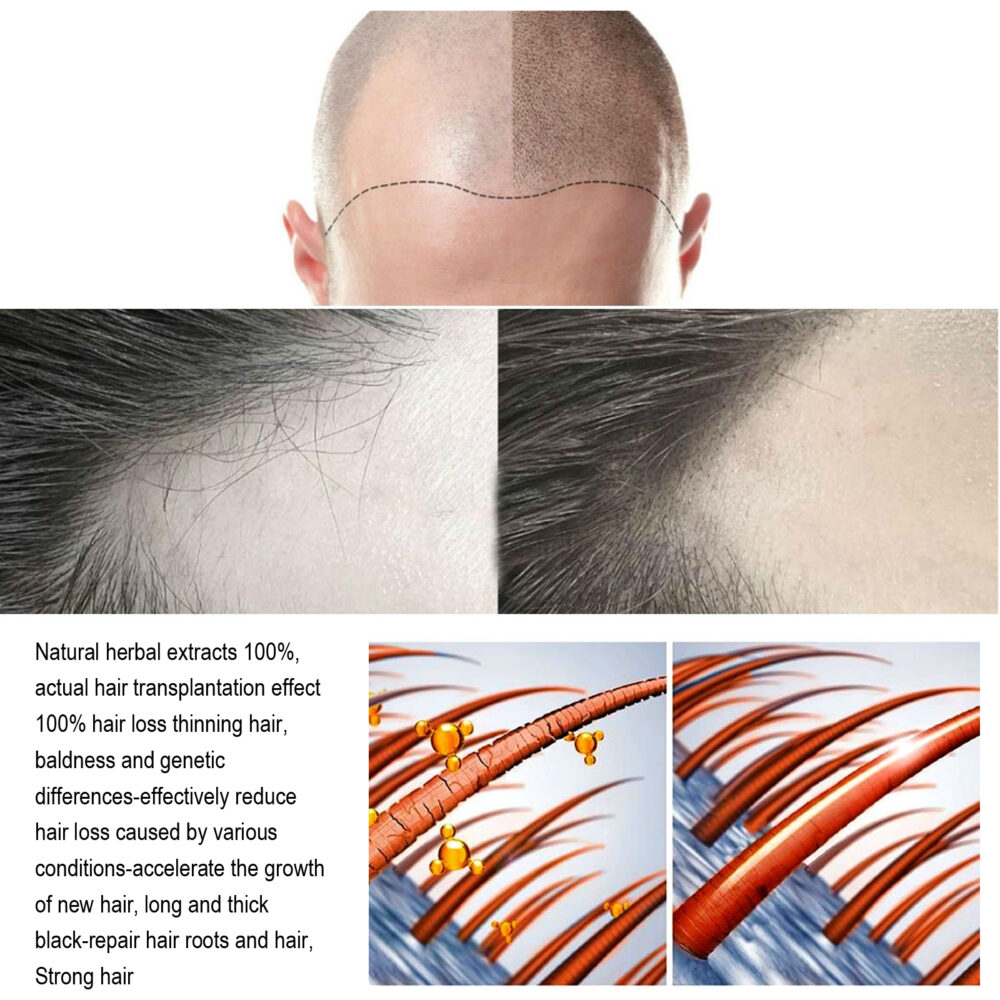 Ginger Hair Care Liquid - Image 3