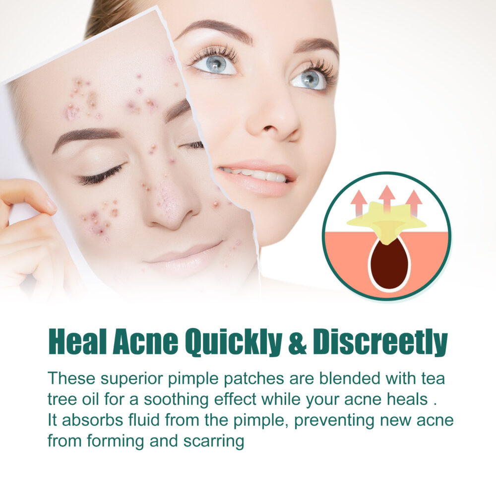 Water colloid star shaped acne patch - Image 4