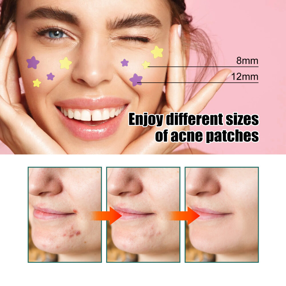 Water colloid star shaped acne patch - Image 5