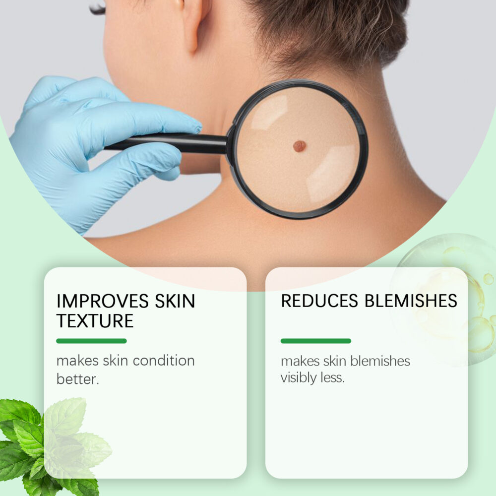 Lighten spot and remove nevus repair gel - Image 3