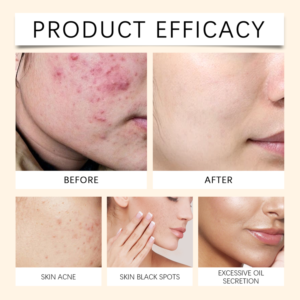 Brighten moisturize soothe spray - Image 7