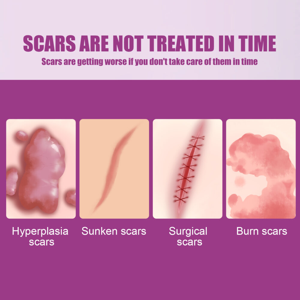 Scar Removal Cream - Image 4