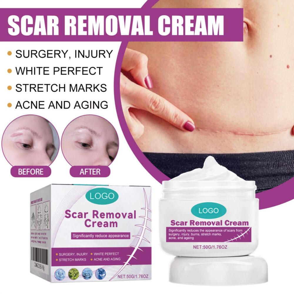 Scar Removal Cream - Image 2