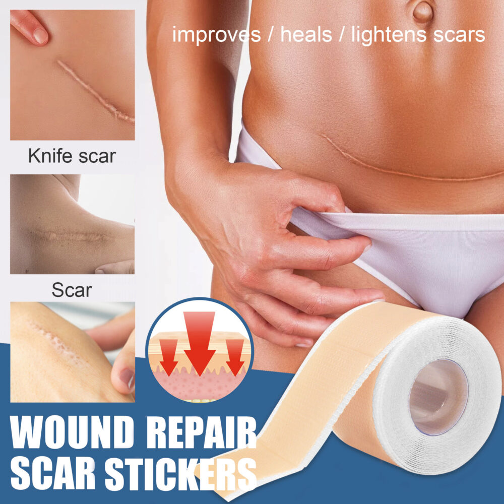 Silicone scar patch - Image 2