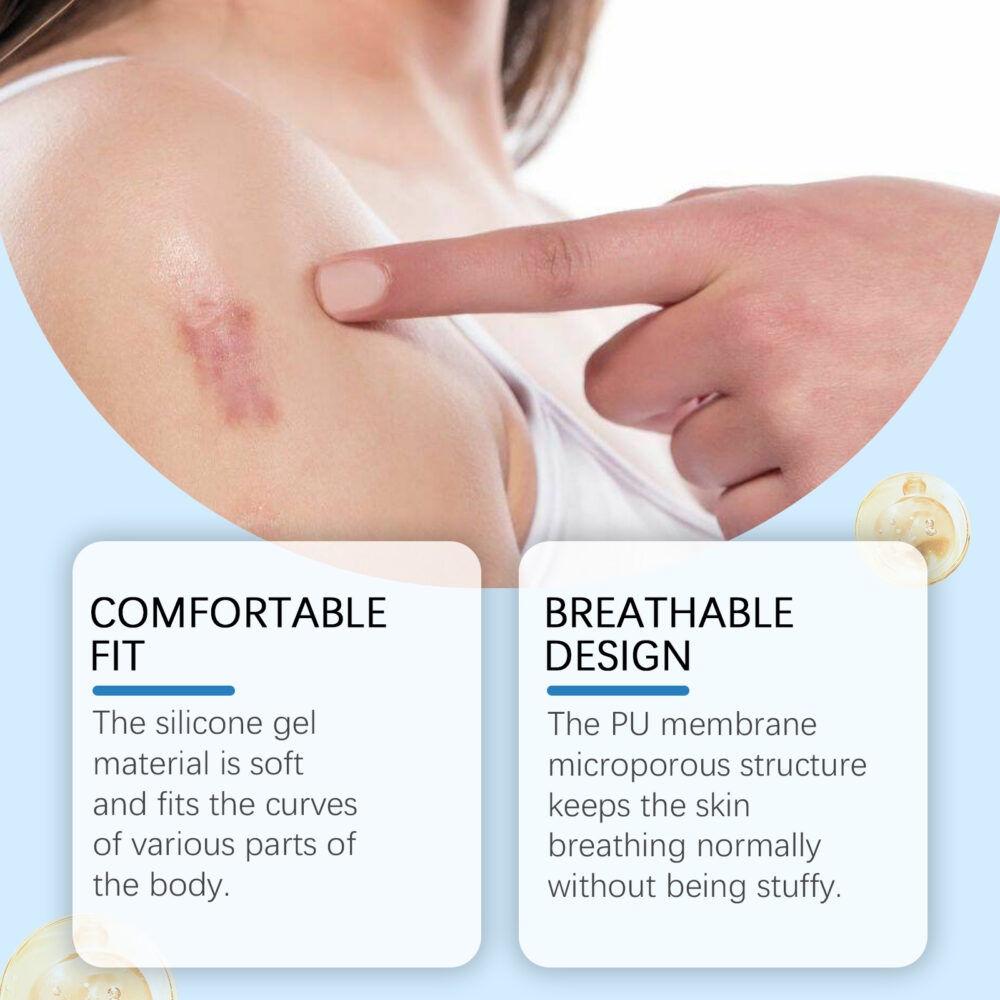 Self adhesive silicone scar patch - Image 2