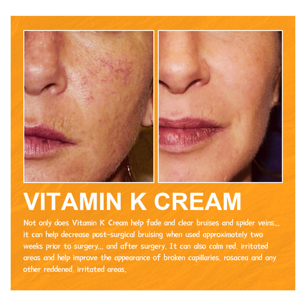 Vitamin K Cream - Image 6