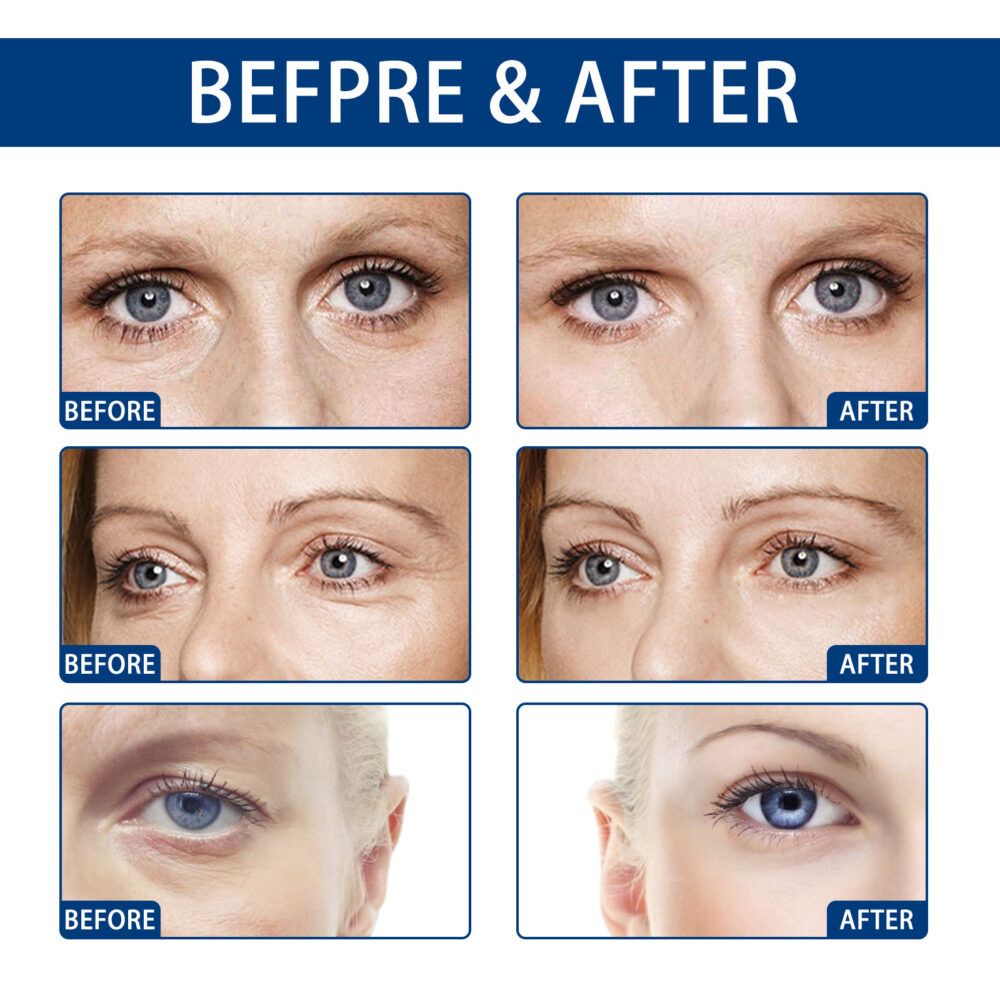 Collagen eye cream removing dark circles - Image 5