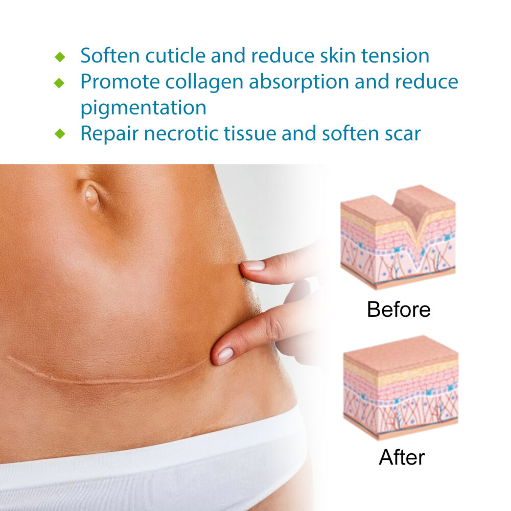 Silicone skin care patch - Image 4