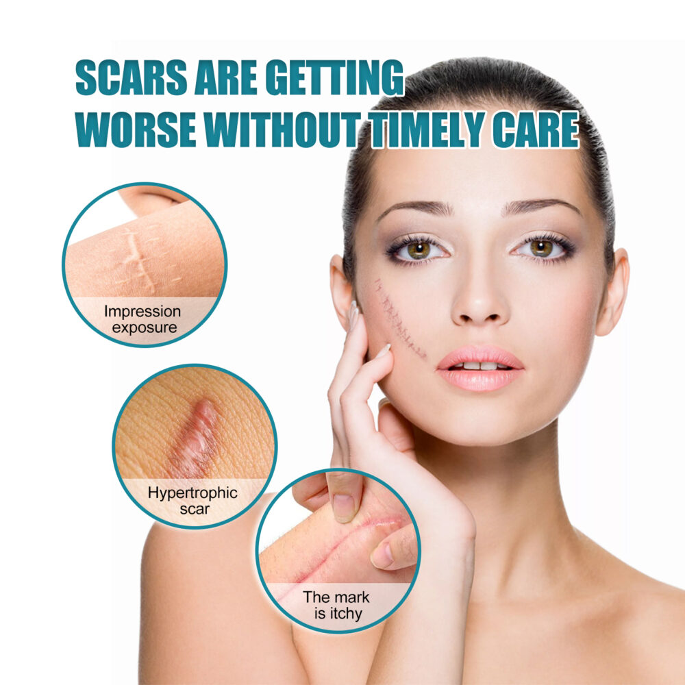 Silicone skin care patch - Image 5