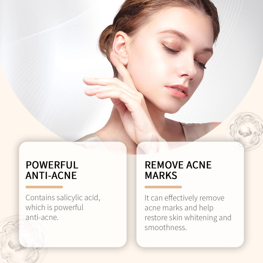 Lavender Mint Soothing Acne Cream - Image 3