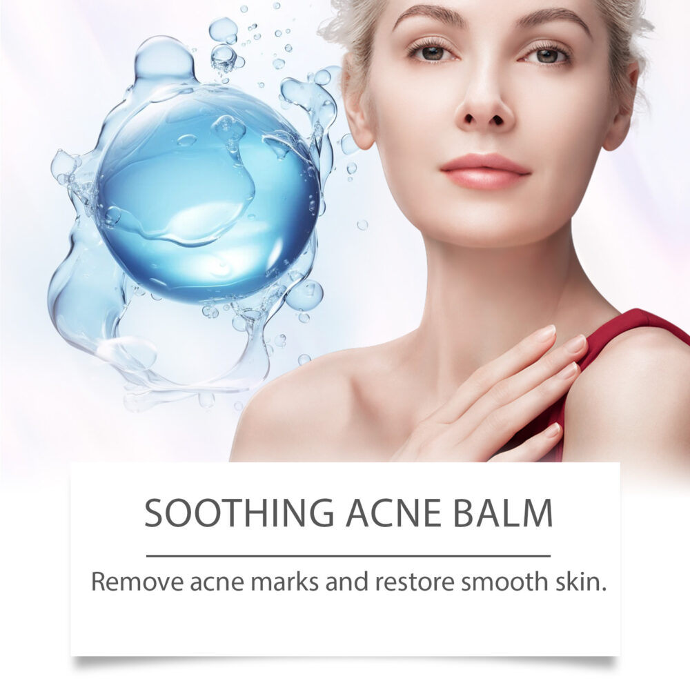 Lavender Mint Soothing Acne Cream - Image 4