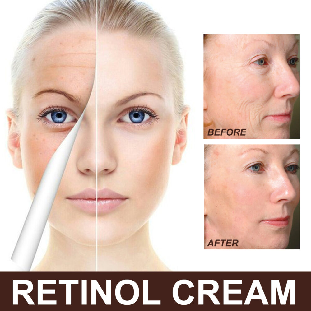 Retinol face cream - Image 6