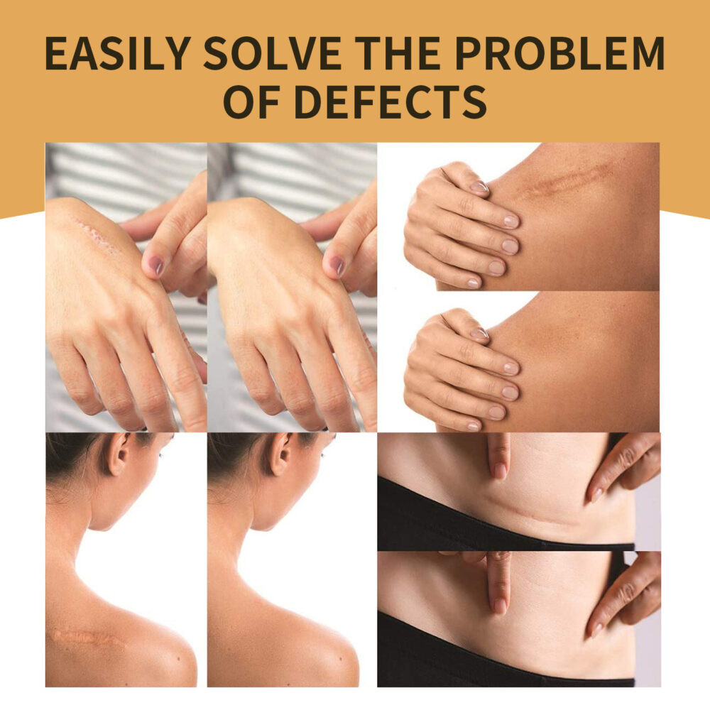 Invisible concealer - Image 3