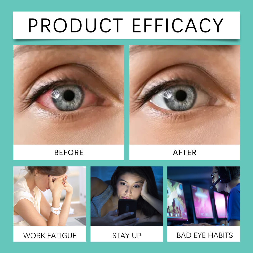Eye care roller - Image 4